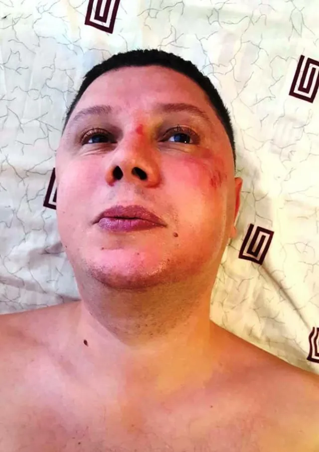 У Хмельницькому скоїли напад на громадського активіста та голову «Автомайдану» — фото 2